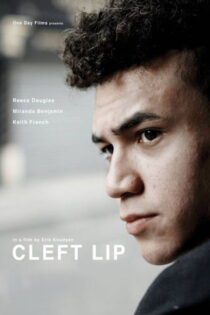 دانلود فیلم Cleft Lip 2018 دانلود فیلم Cleft Lip 2018